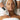 DERMAPEN 4 MICRONEEDLING TREATMENT