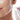 THREAD LIFT - NON-SURGICAL FACE LIFT