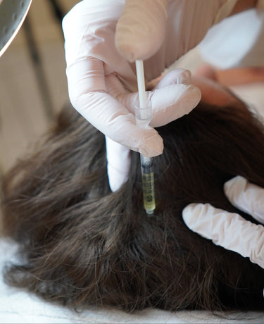 PRP - PLASMA TREATMENT